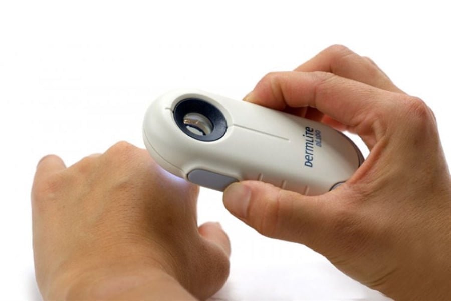 ダーモスコピー DermLite DL100 3Gen Dermatoscópio Dermlite DL100 - 3GEN | Bleymed Equipamentos Médicos