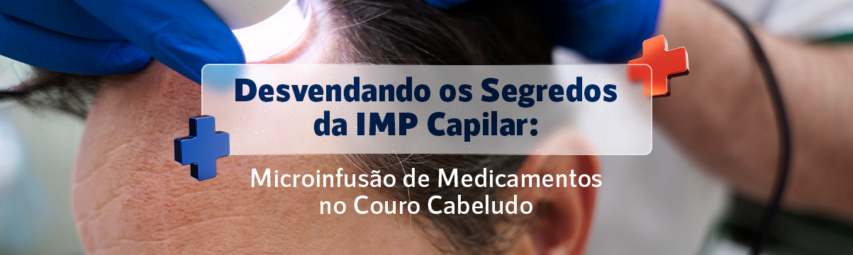 Desvendando os Segredos da IMP Capilar: Microinfusão de Medicamentos no Couro Cabeludo