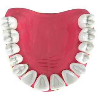 Dentição com Todos os Dentes Removíveis